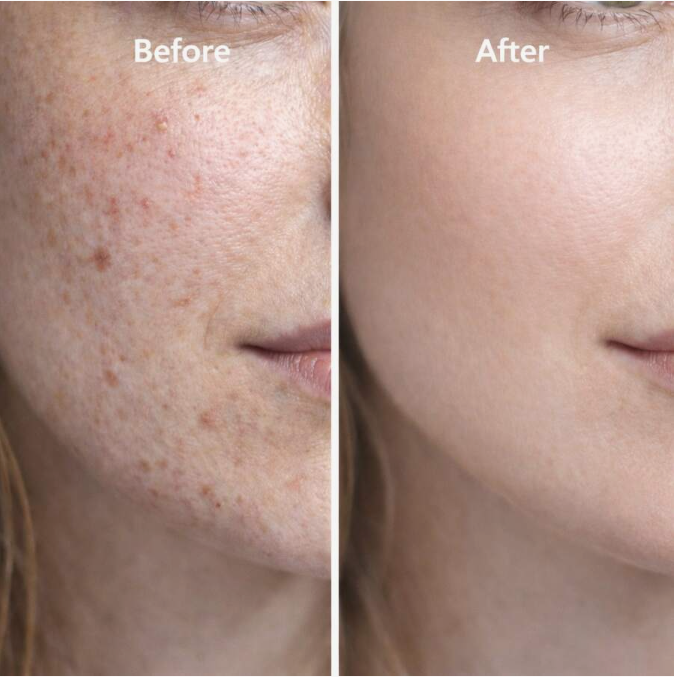 Zenvéa GHK-Cu Copper Peptide Renewal Cream