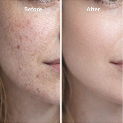 Zenvéa GHK-Cu Copper Peptide Renewal Cream